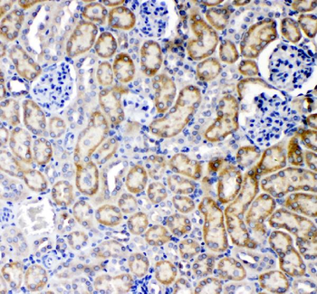 Anti-TNF Receptor I/TNFRSF1A Antibody