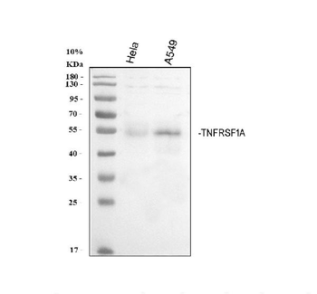 Anti-TNF Receptor I/TNFRSF1A Antibody