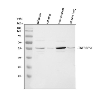 Anti-TNF Receptor I/TNFRSF1A Antibody