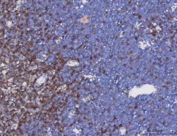 TCR alpha/TRAC Antibody