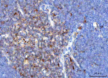 TCR alpha/TRAC Antibody