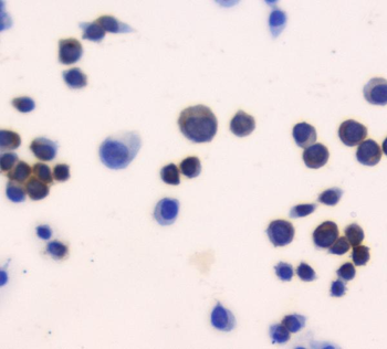 Anti-Thioredoxin/TRX/Txn Antibody
