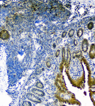 Anti-Thioredoxin/TRX/Txn Antibody