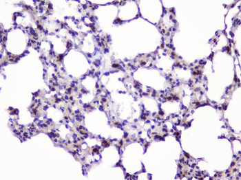 Anti-UBE2I UBC9 Antibody