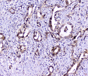 Anti-UBE2I UBC9 Antibody