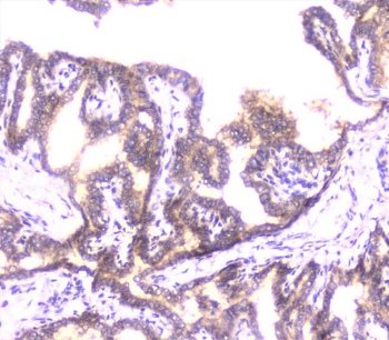 Anti-UBE2I UBC9 Antibody