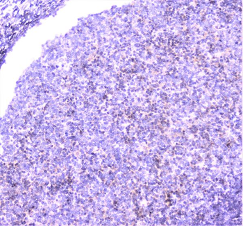 Anti-UBE2I UBC9 Antibody