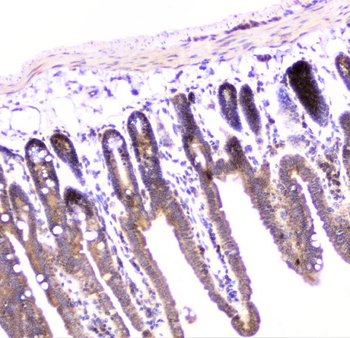 Anti-UBE2I UBC9 Antibody