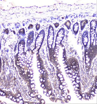 Anti-UBE2I UBC9 Antibody