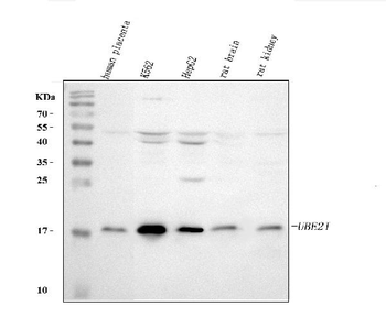 Anti-UBE2I UBC9 Antibody