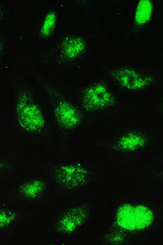 Anti-UBE2I UBC9 Antibody