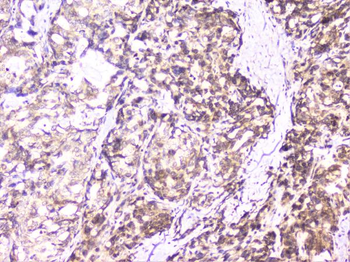 Anti-UBE2I UBC9 Antibody