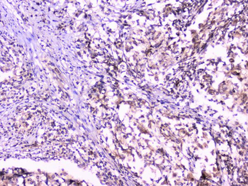 Anti-UBE2I UBC9 Antibody