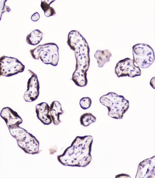 Anti-UBE2I UBC9 Antibody