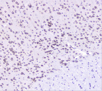 Anti-UBE2I UBC9 Antibody