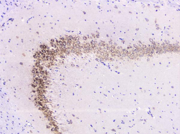 Anti-UBE2I UBC9 Antibody