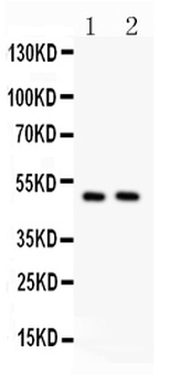 c-Myc Rabbit Polyclonal Antibody