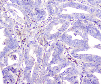 Anti-ADA Antibody (monoclonal, 6D4)