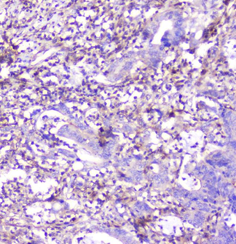 Anti-ADA Antibody (monoclonal, 6D4)