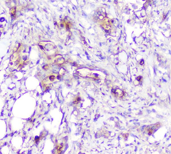 Anti-ADA Antibody (monoclonal, 6D4)