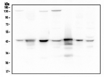 Anti-ADA Antibody (monoclonal, 6D4)