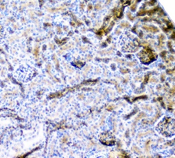 CD2AP Antibody (monoclonal, 5F8)