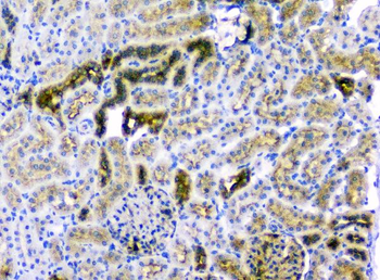 Anti-CD2AP Antibody (monoclonal, 5F8)