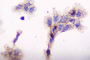 Anti-CD2AP Antibody (monoclonal, 5F8)