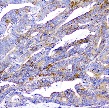 Anti-CD2AP Antibody (monoclonal, 5F8)