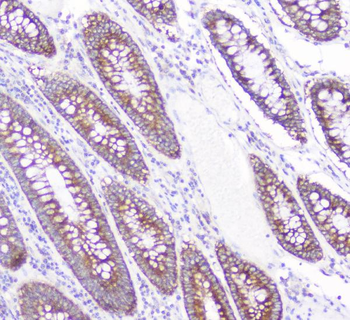 Anti-CD2AP Antibody (monoclonal, 5F8)