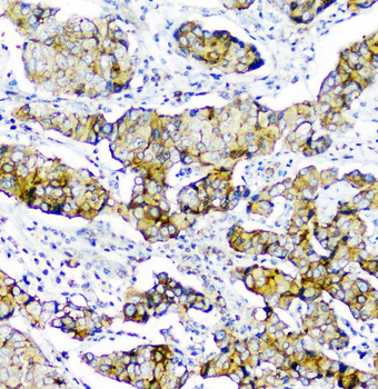 Anti-CD2AP Antibody (monoclonal, 5F8)