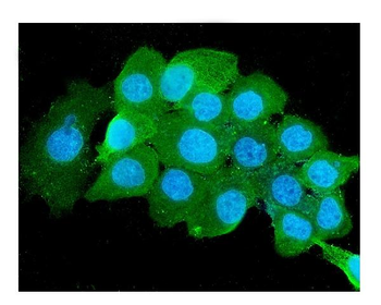 Anti-Beta 2 Microglobulin B2M Antibody (monoclonal, 2H10)