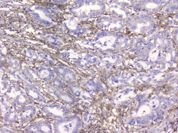 Anti-Beta 2 Microglobulin B2M Antibody (monoclonal, 2H10)