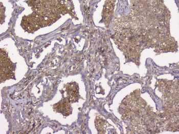 Anti-Beta 2 Microglobulin B2M Antibody (monoclonal, 2H10)