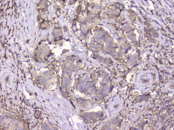 Anti-Beta 2 Microglobulin B2M Antibody (monoclonal, 2H10)