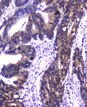 Anti-PPID Antibody (monoclonal, 5A6)