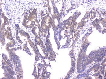 Anti-PPID Antibody (monoclonal, 5A6)