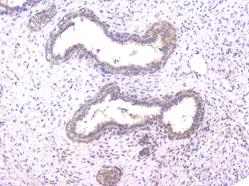 Anti-PPID Antibody (monoclonal, 5A6)