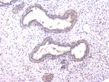 PPID Antibody (monoclonal, 5A6)