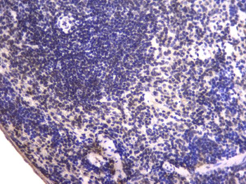 Anti-EWSR1 Antibody (monoclonal, 4B4)