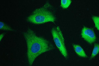Anti-Calpain 2 CAPN2 Antibody (monoclonal, 8I6)