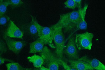 Anti-Calpain 2 CAPN2 Antibody (monoclonal, 8I6)