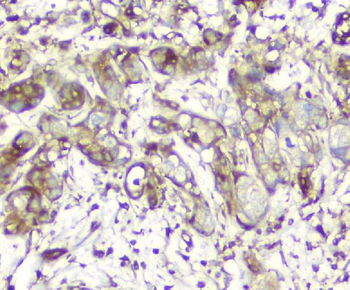 Anti-Calpain 2 CAPN2 Antibody (monoclonal, 8I6)