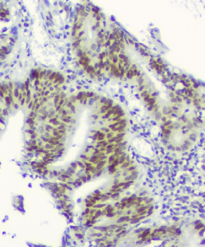 RPA70 RPA1 Antibody (monoclonal, 11H4)