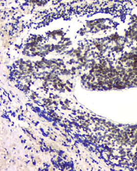 RPA70 RPA1 Antibody (monoclonal, 11H4)