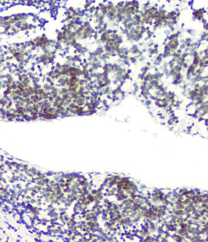RPA70 RPA1 Antibody (monoclonal, 11H4)