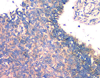 Anti-FH Antibody (monoclonal, 9D8)