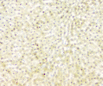 Anti-FH Antibody (monoclonal, 9D8)