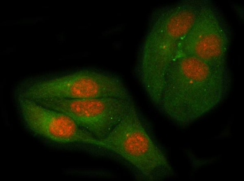 c-Myc Rabbit Polyclonal Antibody