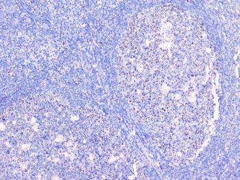Anti-BCL6 Antibody